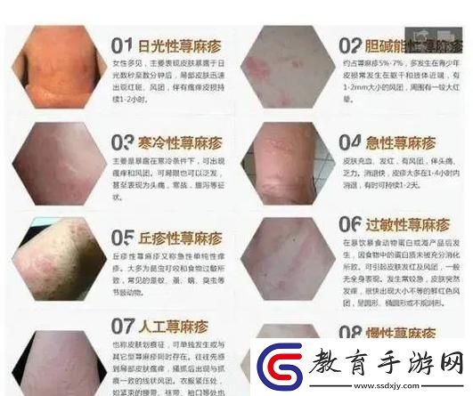 “疙瘩潮流”