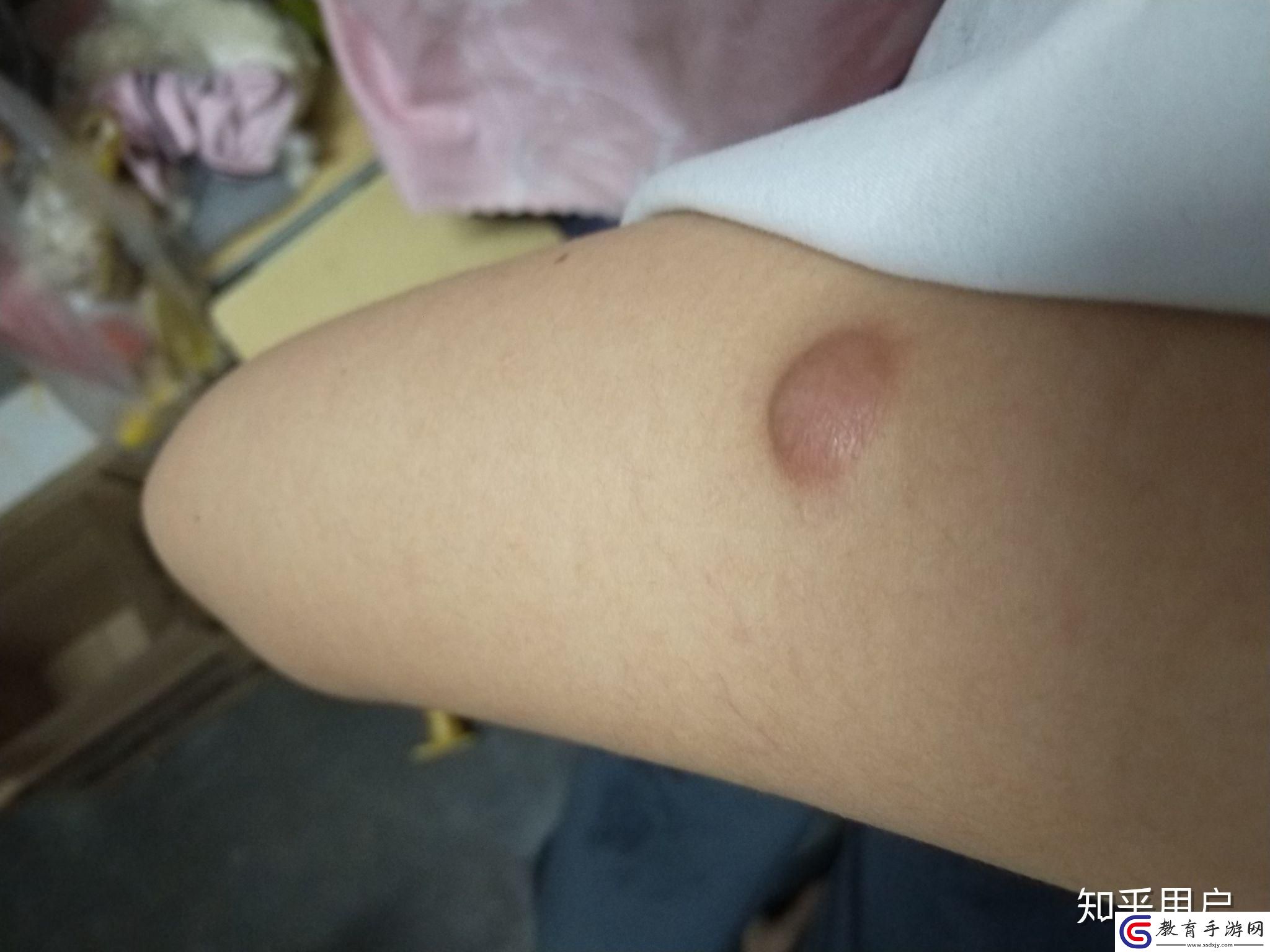硬硬的東西