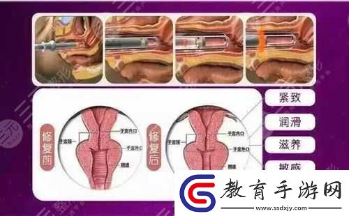 歐洲之星私密緊致