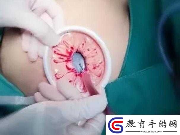 腹部灌滿隆起**令人震撼的奇特景象