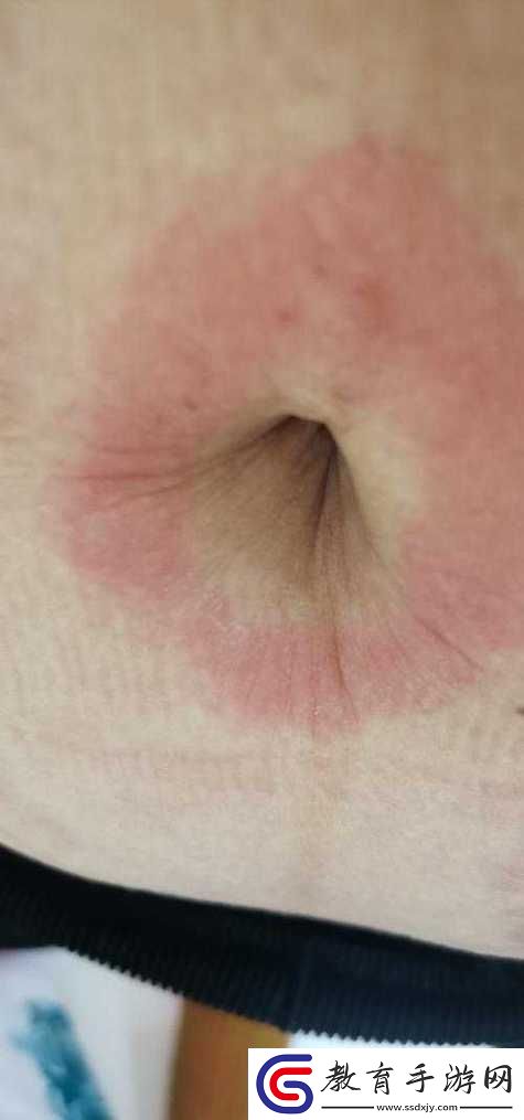 淑芬大腿中間又癢了