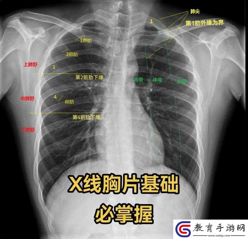 100%胸片曝光率軟件