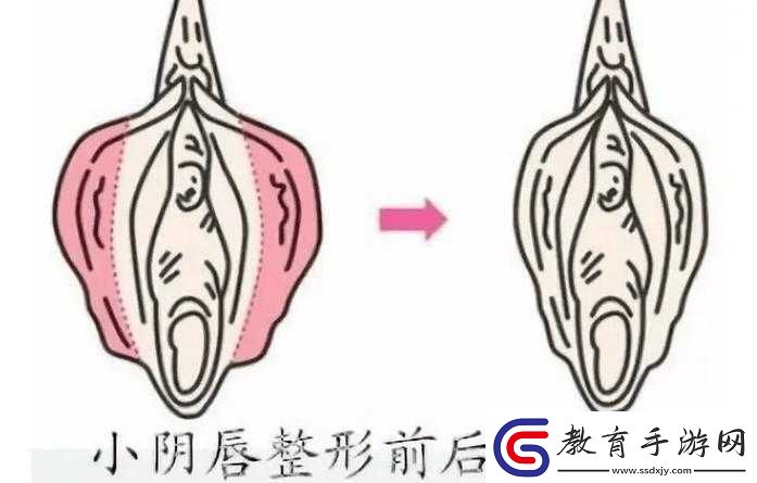 女性三角毛毛區長了個硬疙瘩
